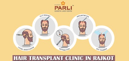 Hair Transplant Clinic in Rajkot - Consult Hair Transplant Specialist Doctor in Rajkot Gujarat