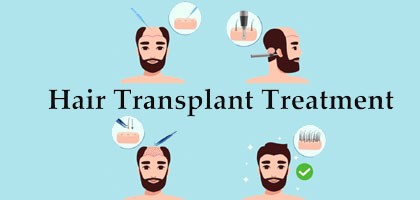 Hair Transplant in Rajkot Best Hair Transplant Centre in Rajkot